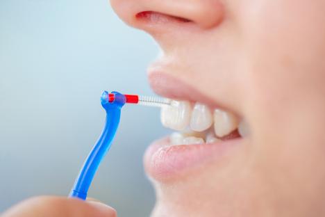 Close-up of a woman using an interdental brush.
