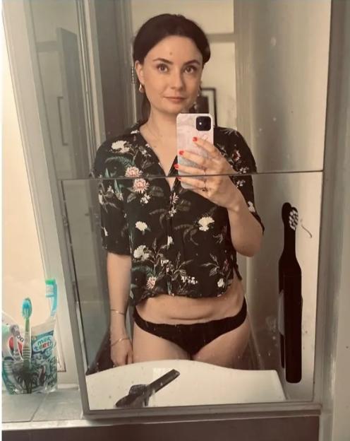 Jennifer Kirby's selfie showing her C-section scar.