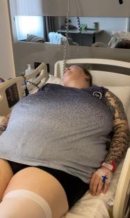 Woman sleeping in a hospital bed.