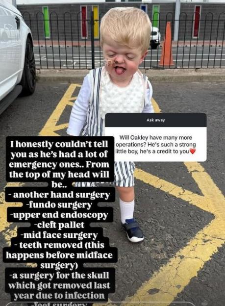 Toddler standing outside, text overlay lists his upcoming surgeries.