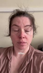 Close-up photo of a woman's face after giving birth; her hair is messy.