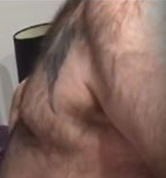 Close-up of a hairy man's back and shoulders.