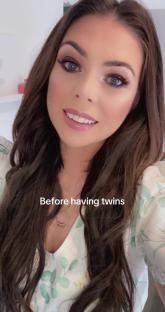 Woman before having twins.
