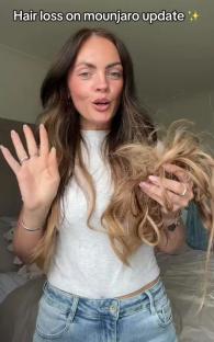 Woman showing hair loss while discussing Mounjaro.