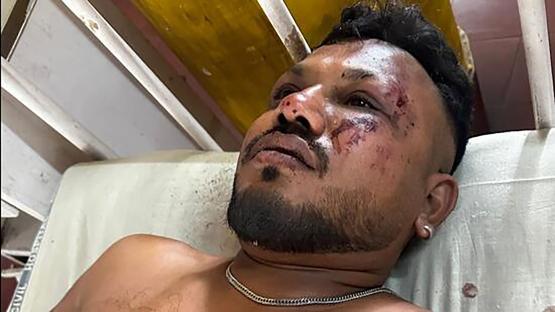 A man with facial injuries lies in a hospital bed.