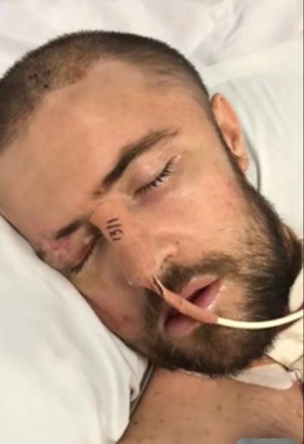 Man in hospital bed with facial injuries.