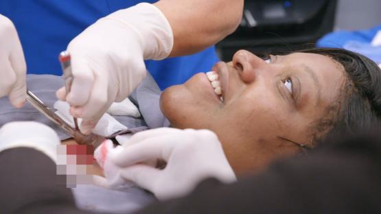 Close-up of a woman undergoing chest surgery.