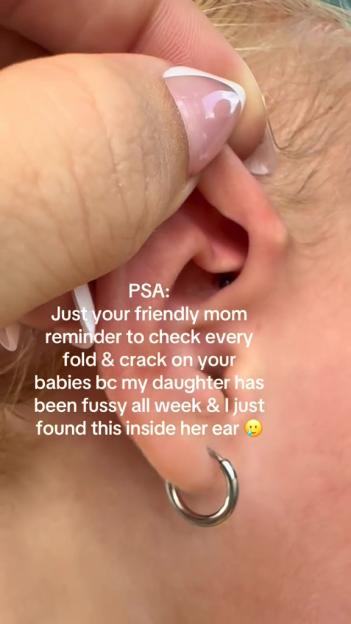 A baby's ear with a hoop earring inside.