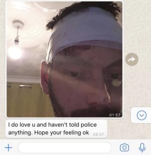 WhatsApp messages showing photos of a book and an injured man's face, along with a message indicating a home invasion.