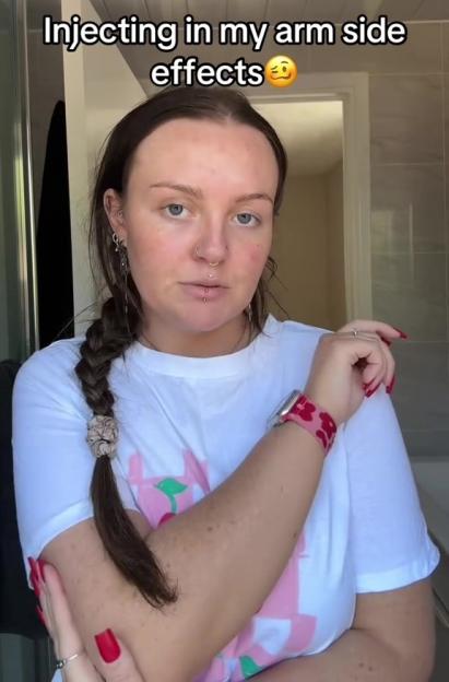 Woman showing arm injection site side effects.