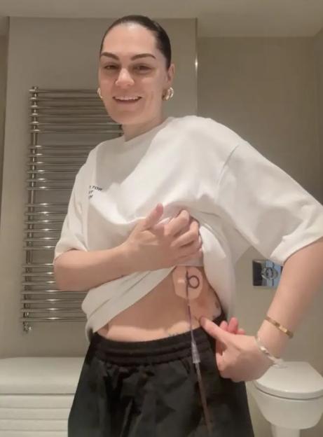 Woman showing drain on stomach after surgery.