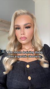 Woman after gastric sleeve surgery.