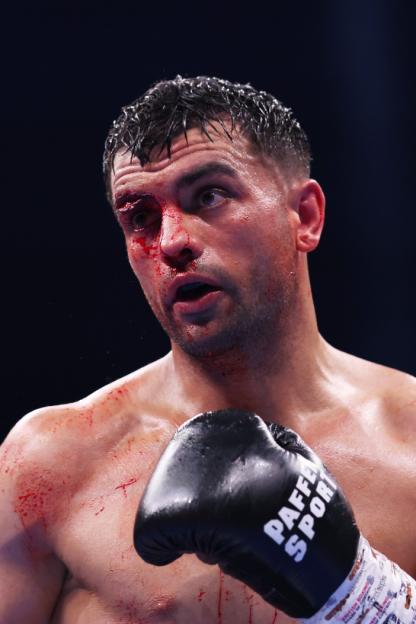 MANCHESTER, ENGLAND - JULY 05: Jack Catterall looks on with a cut to his right eye during his IBF Inter-Continental Welterweight title fight against Harlem Eubank on 'The Warrior Code' fight card at AO Arena on July 05, 2025 in Manchester, England. (Photo by Alex Livesey/Getty Images)