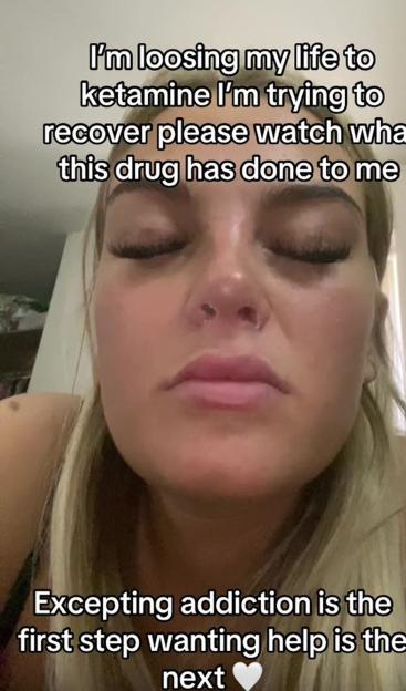 Close-up of a woman's face with text overlay describing her ketamine addiction and recovery.