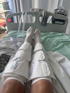 Person's legs in compression sleeves in a hospital bed.