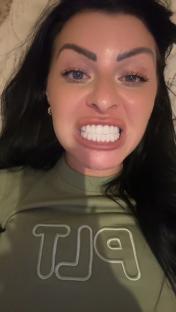 Close-up video of a woman showing off her new teeth after a dental procedure in Turkey.