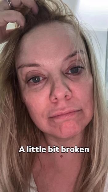 Close-up photo of a woman’s face, appearing tired and emotional; text overlay reads “A little bit broken.”
