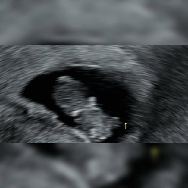 AOA&#8217;s Yuna Announces Pregnancy 3