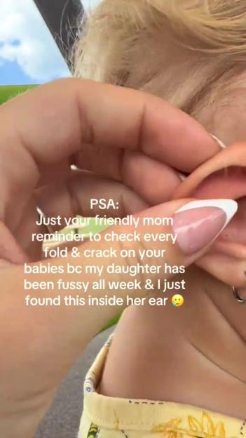 Close-up of a hand removing an object from a baby's ear.