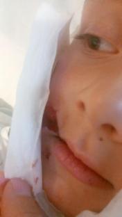 Close-up photo of a child's face with injuries.
