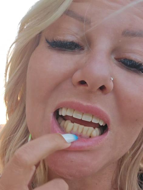Close-up video still of a woman showing her teeth before veneers.