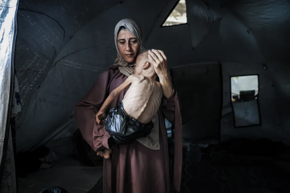 Woman holding emaciated child in a tent.