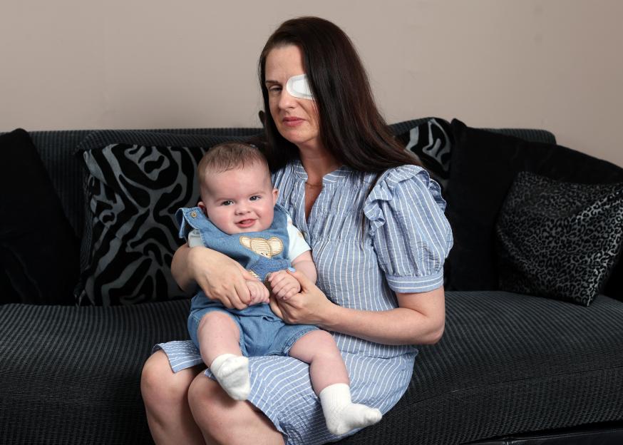 A mother holds her baby son while wearing an eye patch.