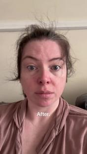 Woman's before-and-after photo, showing her appearance after giving birth.