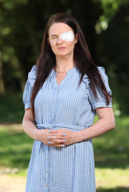 Woman with an eye patch.
