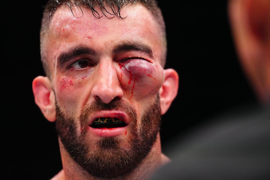 Close-up of a fighter's bloodied face after a match.