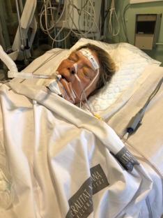 Woman in hospital bed with medical tubes.