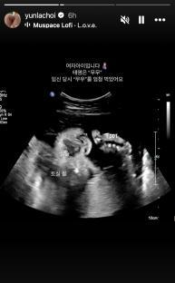 Choi Yoon Ra Announces Pregnancy With Baby Bump Photos 3