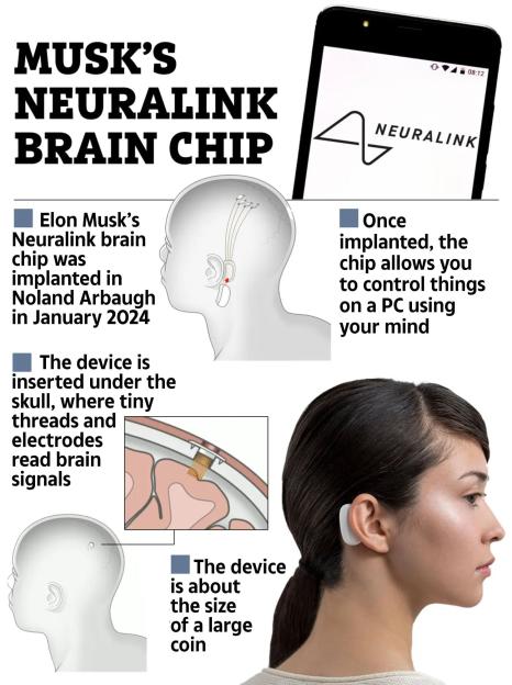 a poster about musk 's neuralink brain chip