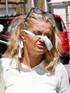 Danniella Westbrook leaving the hospital after nose surgery.