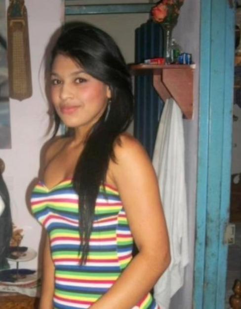 Photo of Tatiana Murillo before surgery.