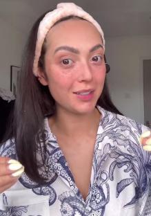 Woman with freckles showing her natural look without fillers.