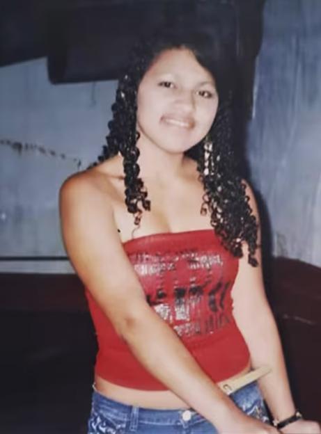 Photo of Tatiana Murillo before cosmetic procedures.