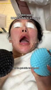 Woman receiving twelve consecutive skin laser treatments in Korea.