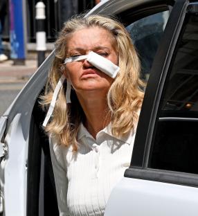 Danniella Westbrook leaving a hospital with a bandage on her nose.
