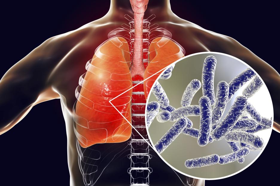 Illustration of Legionella pneumophila bacteria in the lungs.