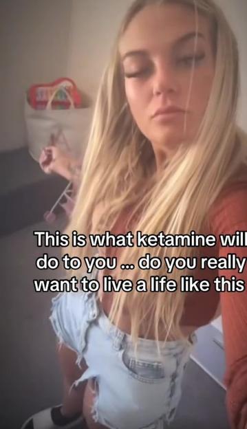 Woman with blonde hair showing the effects of ketamine addiction.