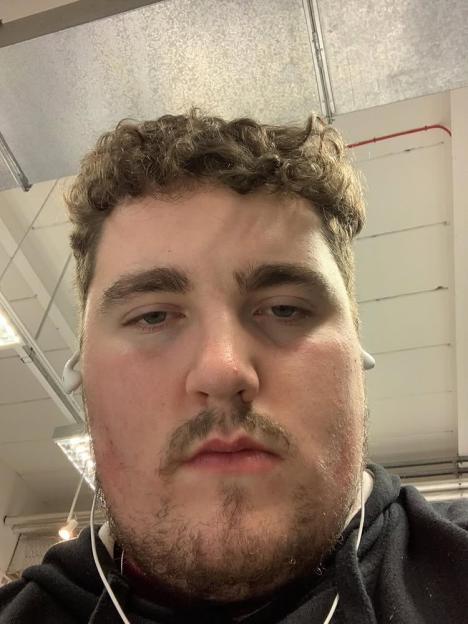 Close-up photo of a man before his weight loss transformation.