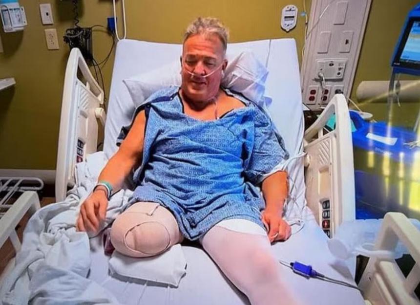 Wrestling legend Buff Bagwell had a significant portion of his right leg amputated