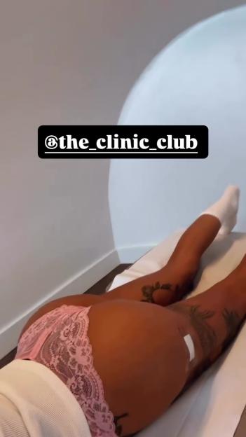 Woman receiving buttocks filler treatment.