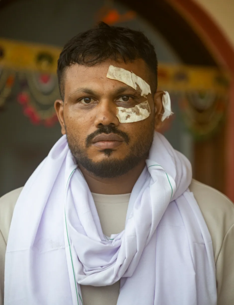 Man with a bandage over his eye.