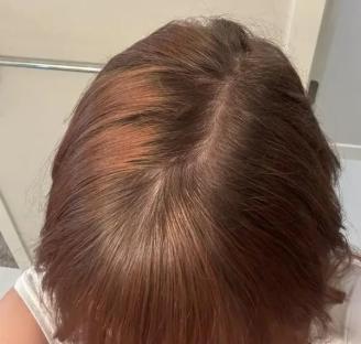 Top view of person's head showing reddish-brown hair.