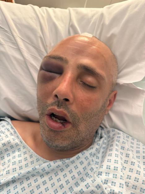 Shocking moment dad was hit by E-bike leaving him "hours from death"