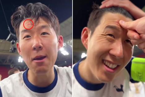 Son Heung-min suffers freak injury during Tottenham’s Europa League final celebrations after being hit in head by TROPHY