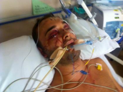 Man in hospital bed with severe facial injuries.
