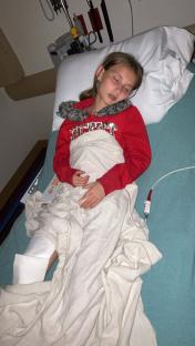 Girl sleeping in a hospital bed with a leg injury.